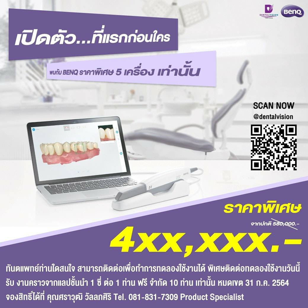 Intraoral Scanner